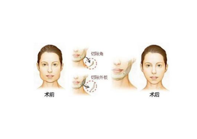 广西医科大学附属第一医院整形科,专家坐诊时间