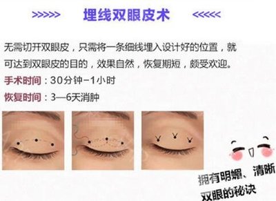 指南|广西医科大整形美容科医生名单,pick双眼皮大咖