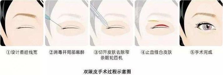 [测评]广西医科大二附院整形美容科怎么样?医生技术+案例评价,附价格表